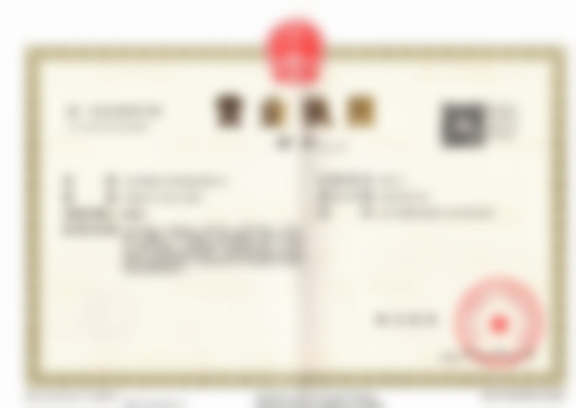 在北京华韩找高海燕医生做下颌缘精细分层吸脂，术后小V脸太绝侧颜杀稳稳拿捏！ 
