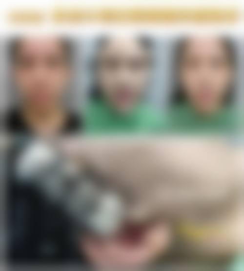 七、福州弘宇整形美容医院预约方式