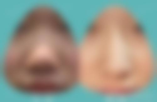 二、上海纽卓医疗美容门诊部怎么样?