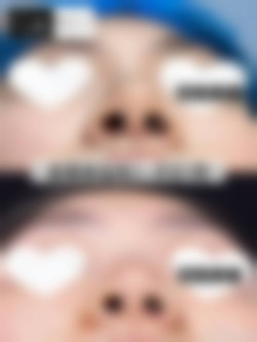 四、广州肌光医疗美容诊所特色项目
