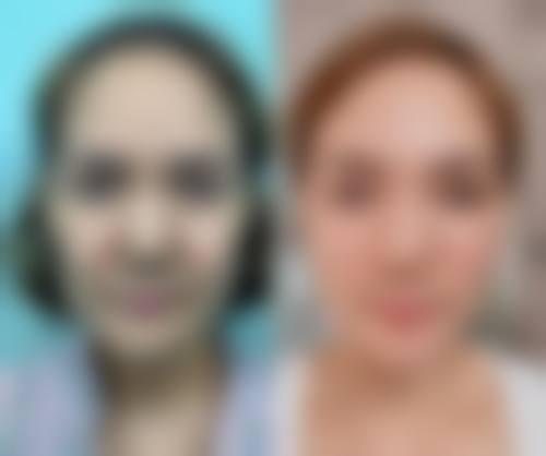 八、广州肌光医疗美容诊所预约方式