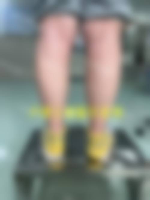 八、长沙暄美齿科整形(袁家岭分院)真实的患者评价