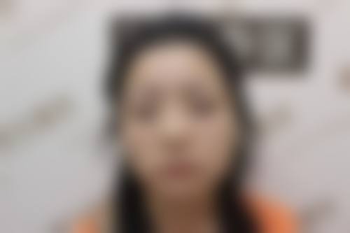 六、深圳青逸植发医院价格表