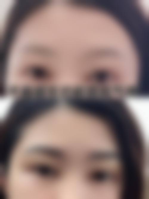 三、青岛洋美植发诊疗项目有哪些?