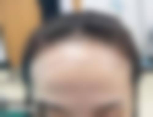 五、深圳青逸植发医院医生介绍