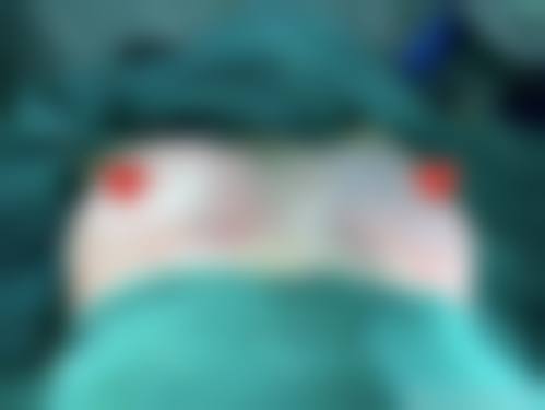 三、韩国Melon整形外科诊疗项目有哪些?