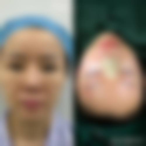 四、六安霍邱曼尼医疗美容门诊部特色项目