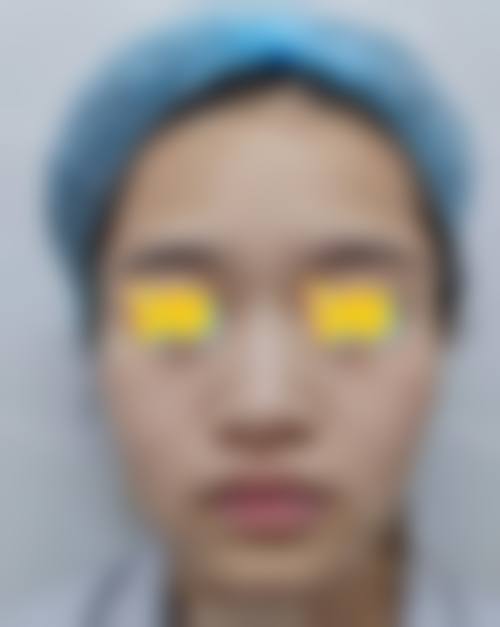 八、六安霍邱曼尼医疗美容门诊部真实的患者评价