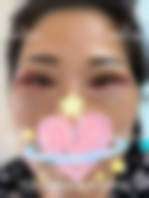 五、乌鲁木齐枫雅隐奢整形医院价格表