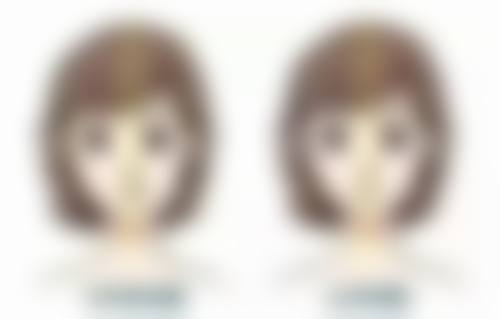 四、女生雨天割双眼皮的术中配合要点