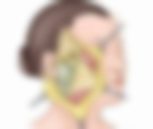 二、激光去除疤痕疙瘩的优势与局限