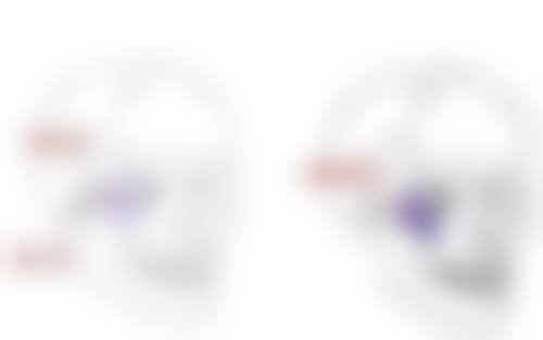 一、隆鼻肋骨有刀口吗?答案揭秘