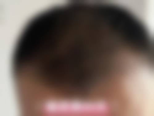 四、成都美熹医疗美容整形诊所特色项目