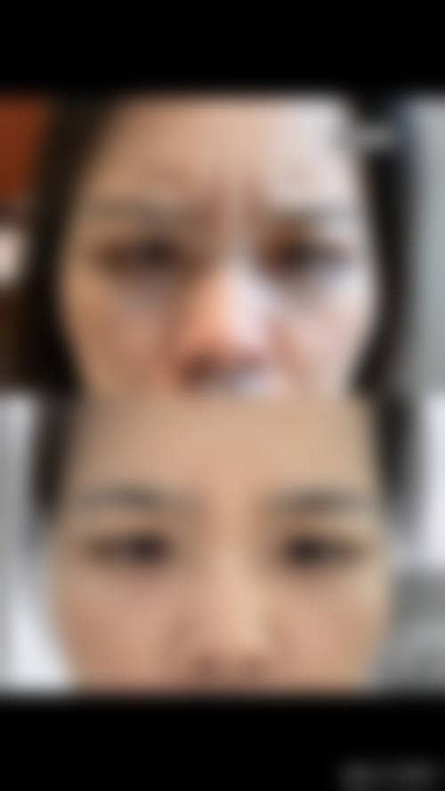 四、河南欣荣医疗美容特色项目