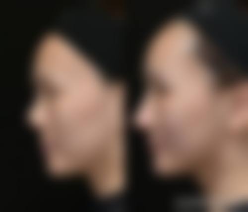 三、莆田维纳斯整形医院诊疗项目有哪些?