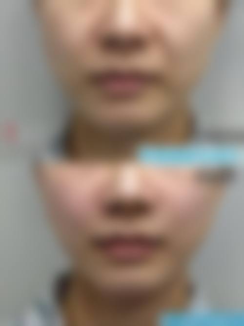 八、河南欣荣医疗美容真实的患者评价
