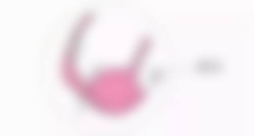五、割双眼皮术后的护理要点