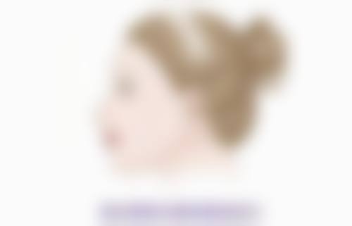 三、凹陷性疤痕治疗注意啥