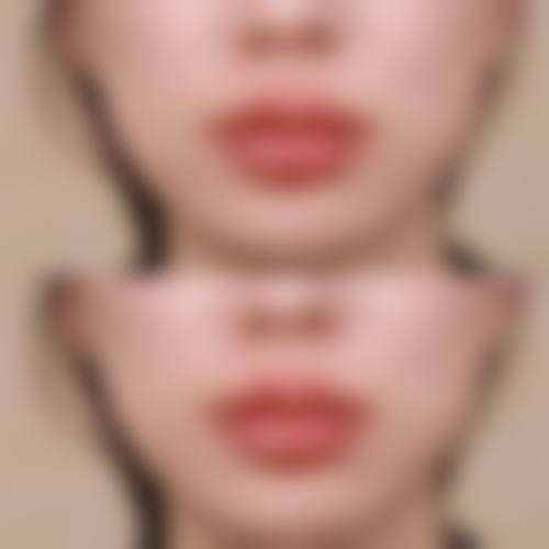 七、沈阳澳紫汣美医疗美容门诊部预约方式