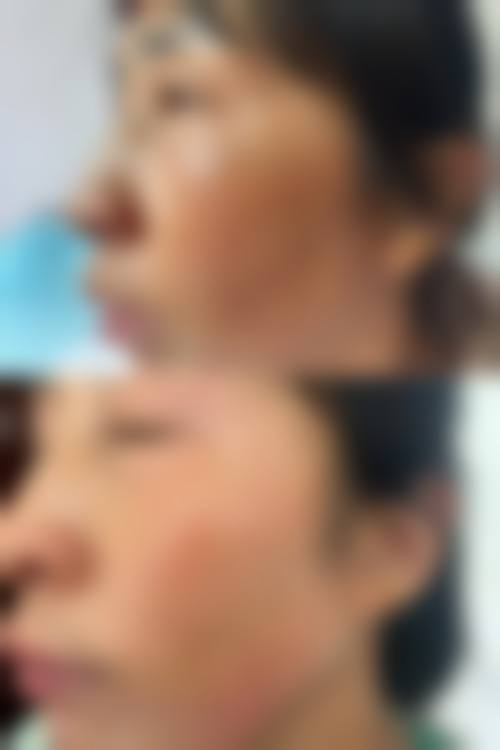 七、邯郸河北工程大学附属医院 - 医疗美容医院地址及交通