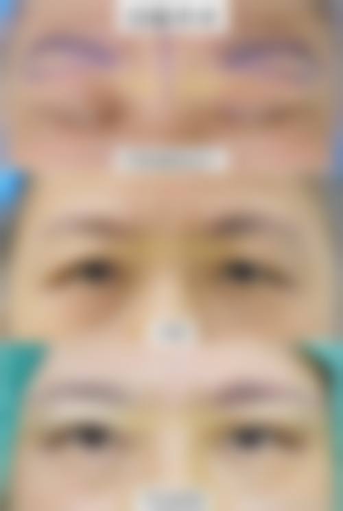 三、邯郸河北工程大学附属医院 - 医疗美容医院诊疗项目有哪些?