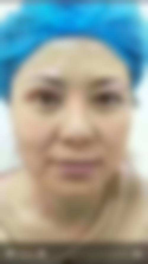 四、邯郸河北工程大学附属医院 - 医疗美容医院特色项目