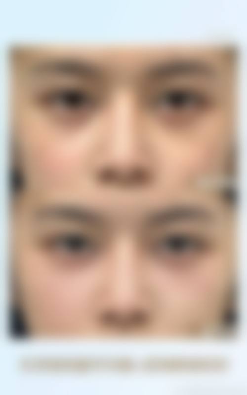 五、沈阳澳紫汣美医疗美容门诊部价格表