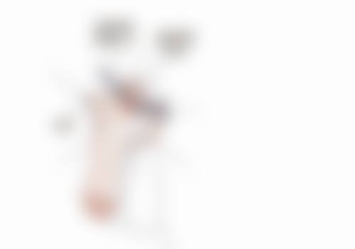 一、年龄增长与双眼皮变三眼皮