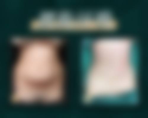 三、梁衍炜技术优势