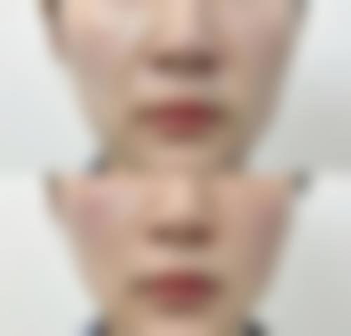 二、日本加藤clinic麻布医院怎么样？