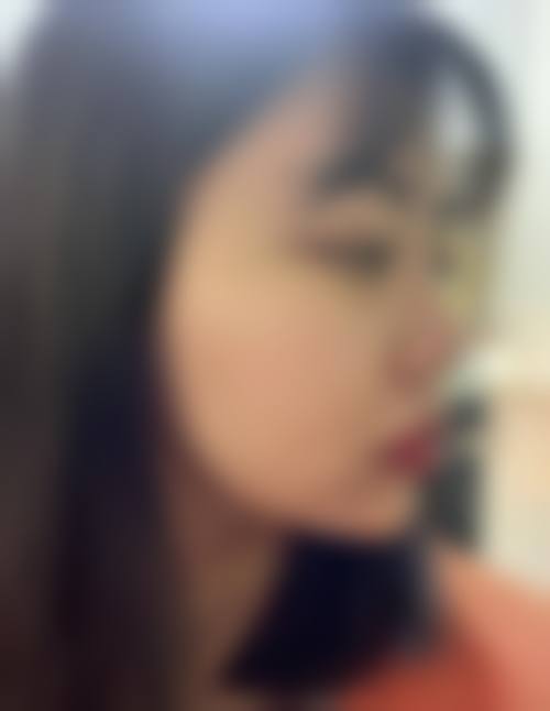 九、太原悦己蜜医疗美容诊所真实的患者评价