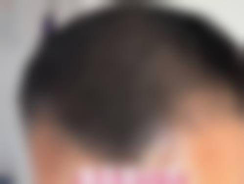 四、安康维美丽莎医疗美容特色项目