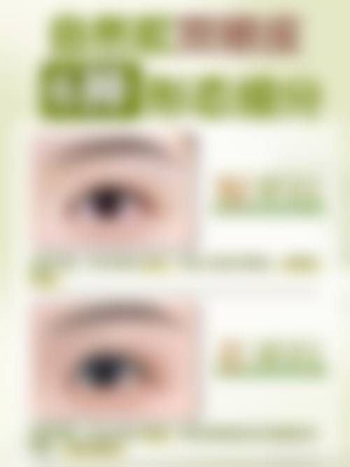 八、深圳美一度医疗美容门诊部真实的患者评价