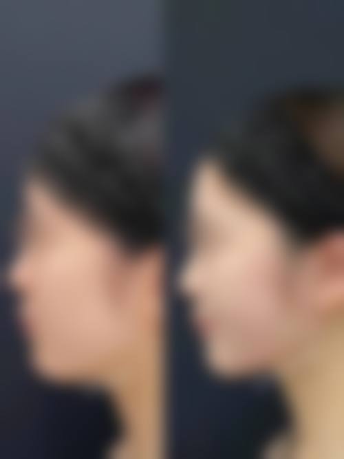 三、胡荣荣技术优势