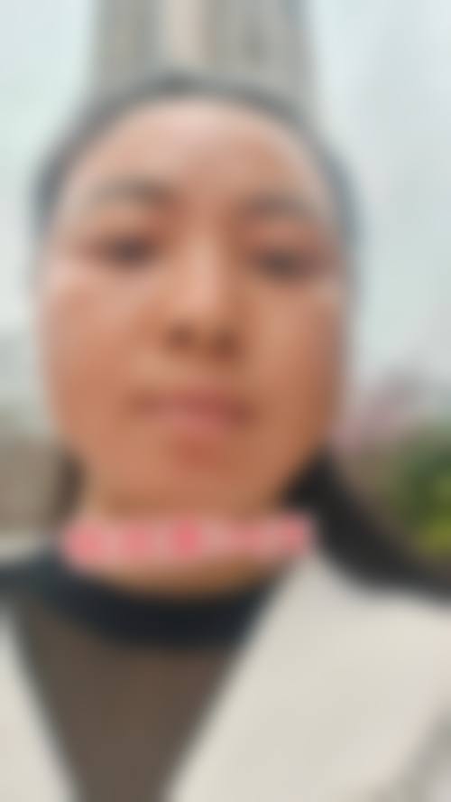 二、深圳美一度医疗美容门诊部怎么样？
