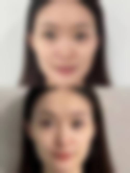 五、宁德蕉城洋颜整形医院价格表