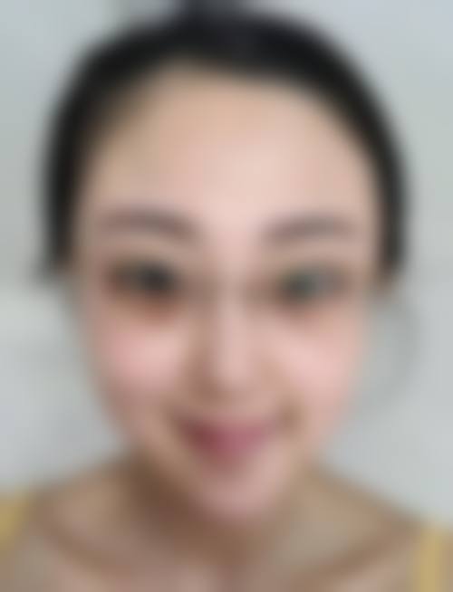 五、深圳美一度医疗美容门诊部价格表