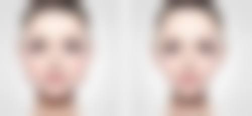 三、去除黑色素疤痕的日常护理小妙招