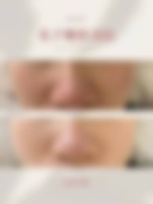九、杭州硕人医疗美容门诊部真实的患者评价
