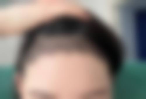 八、西安雍禾植发预约方式