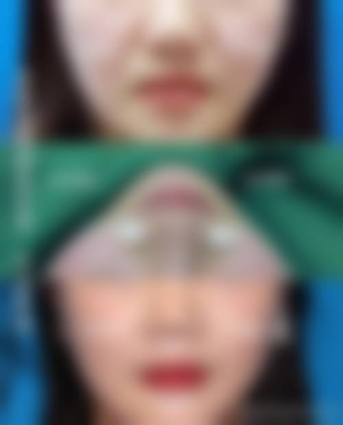六、松原高盛辉医疗美容诊所价格表