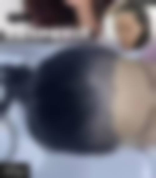 五、宁波新生植发医院价格表