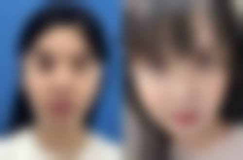 六、樊佳佳真实的患者评价