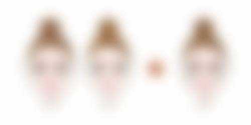 三、怎么才能把增生疤痕消掉之手术治疗