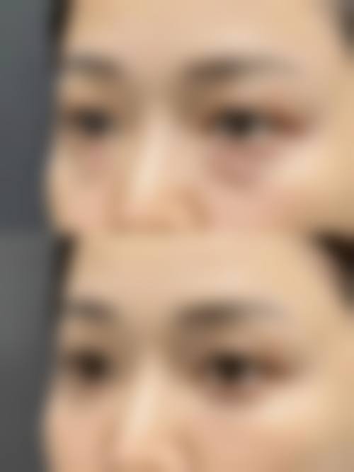 二、陈淑端擅长项目
