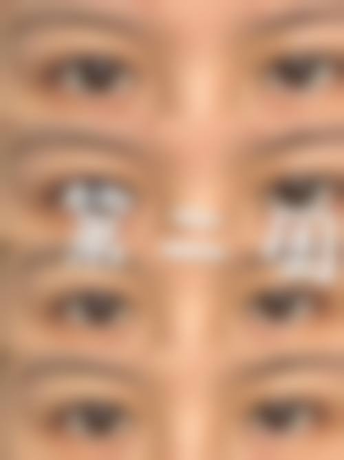 八、西安西美整形外科真实的患者评价