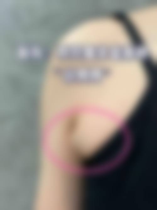 八、天津艾丽苏蔓医疗美容诊所真实的患者评价