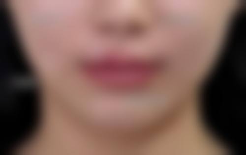 三、天津艾丽苏蔓医疗美容诊所诊疗项目有哪些?
