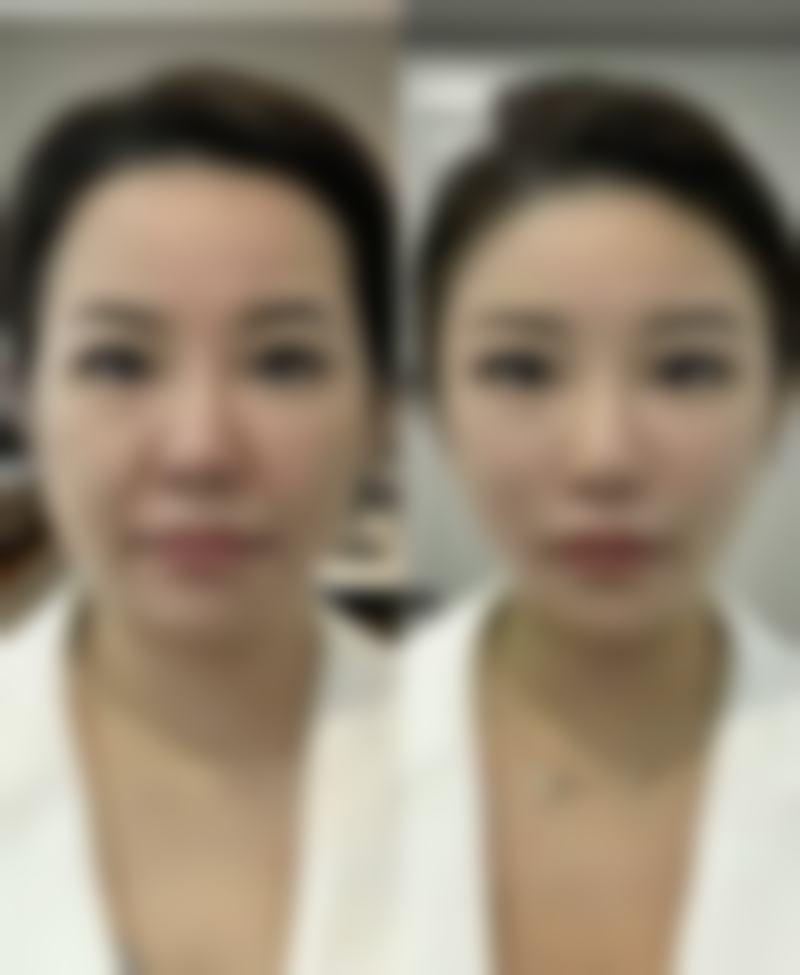 三、陈淑端技术优势